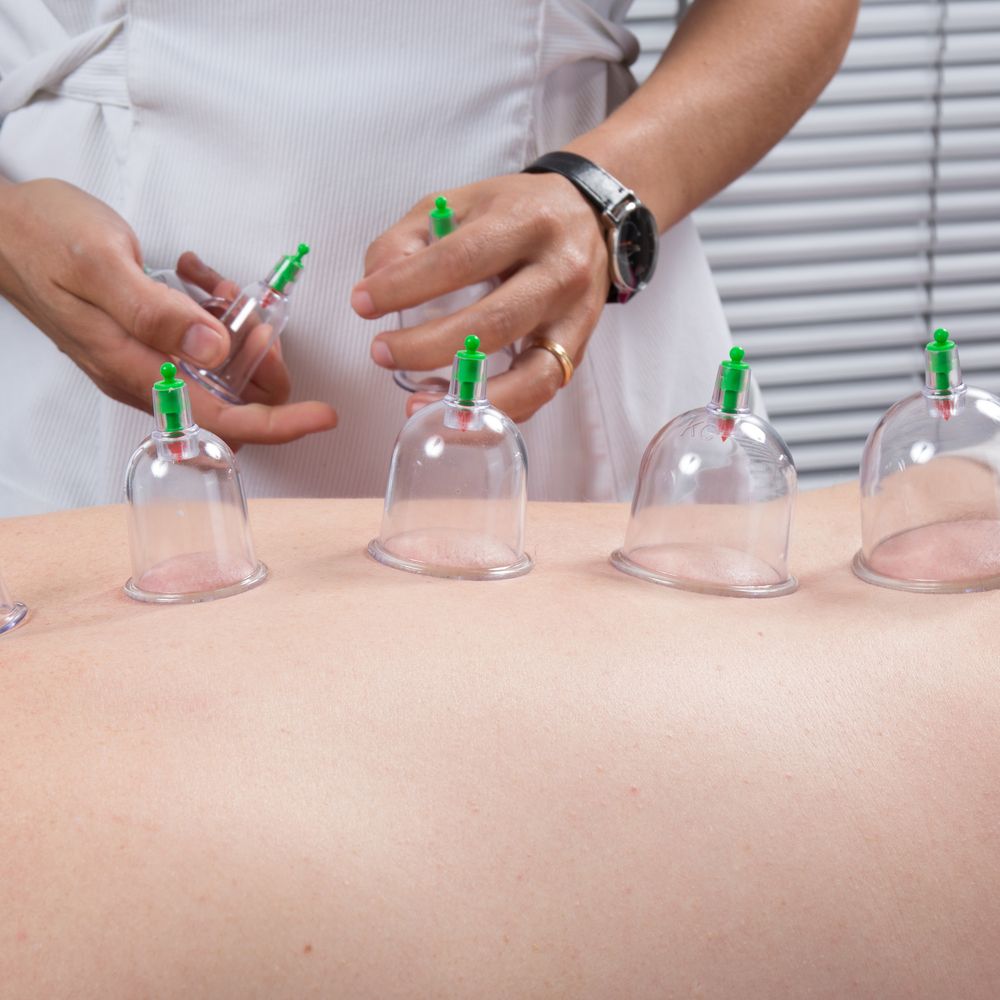 12er Schröpfen Set mit Schröpfgläser aus Kunststoff mit Pumpe Hochwertige Vakuum Massage Vakuumpumpe Cupping Schröpfglas Anti Cellulite Cups Retoo