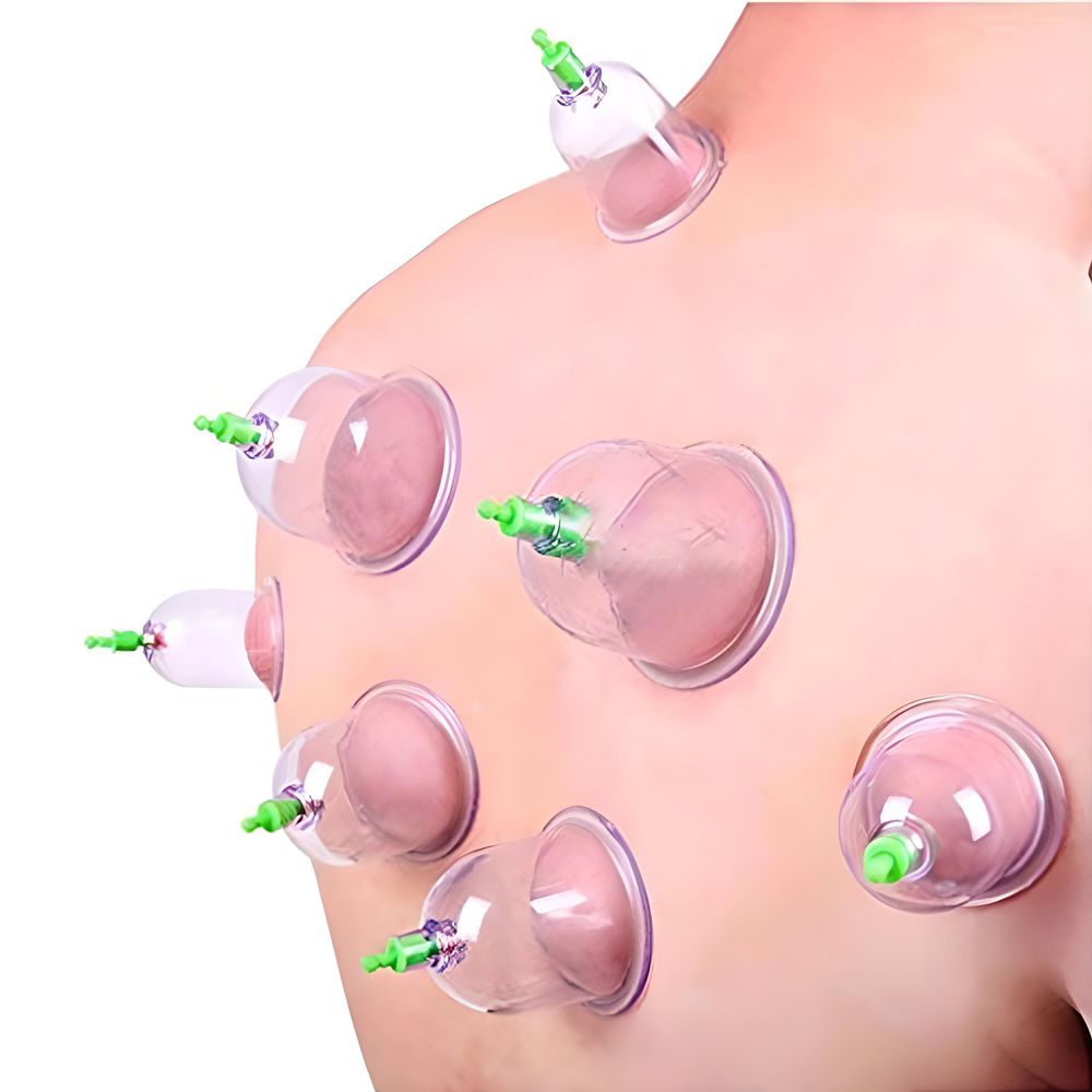 12er Schröpfen Set mit Schröpfgläser aus Kunststoff mit Pumpe Hochwertige Vakuum Massage Vakuumpumpe Cupping Schröpfglas Anti Cellulite Cups Retoo