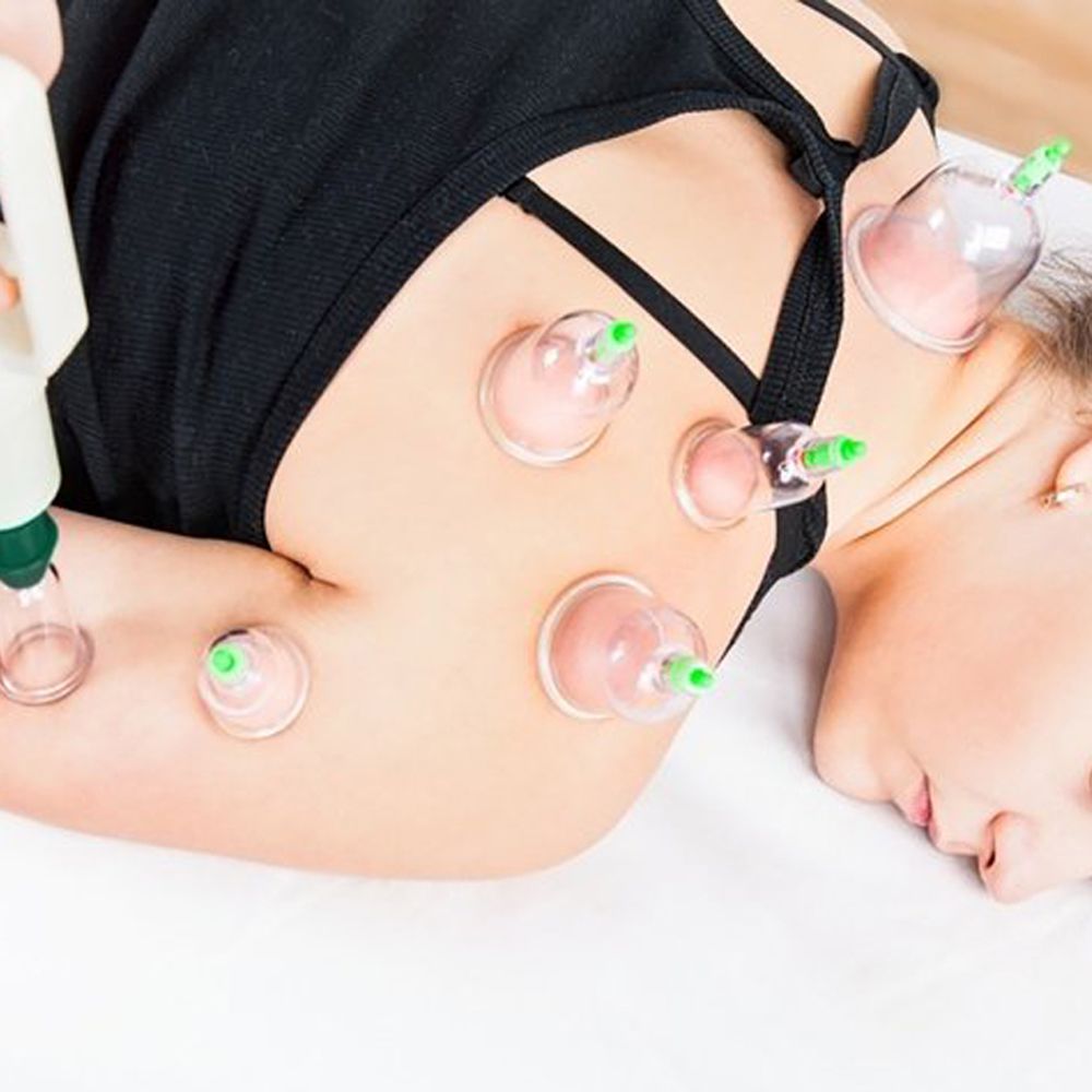 12er Schröpfen Set mit Schröpfgläser aus Kunststoff mit Pumpe Hochwertige Vakuum Massage Vakuumpumpe Cupping Schröpfglas Anti Cellulite Cups Retoo