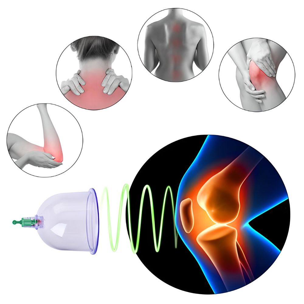 12er Schröpfen Set mit Schröpfgläser aus Kunststoff mit Pumpe Hochwertige Vakuum Massage Vakuumpumpe Cupping Schröpfglas Anti Cellulite Cups Retoo