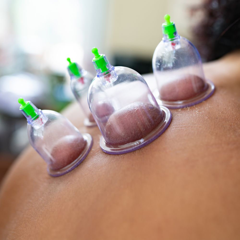12er Schröpfen Set mit Schröpfgläser aus Kunststoff mit Pumpe Hochwertige Vakuum Massage Vakuumpumpe Cupping Schröpfglas Anti Cellulite Cups Retoo