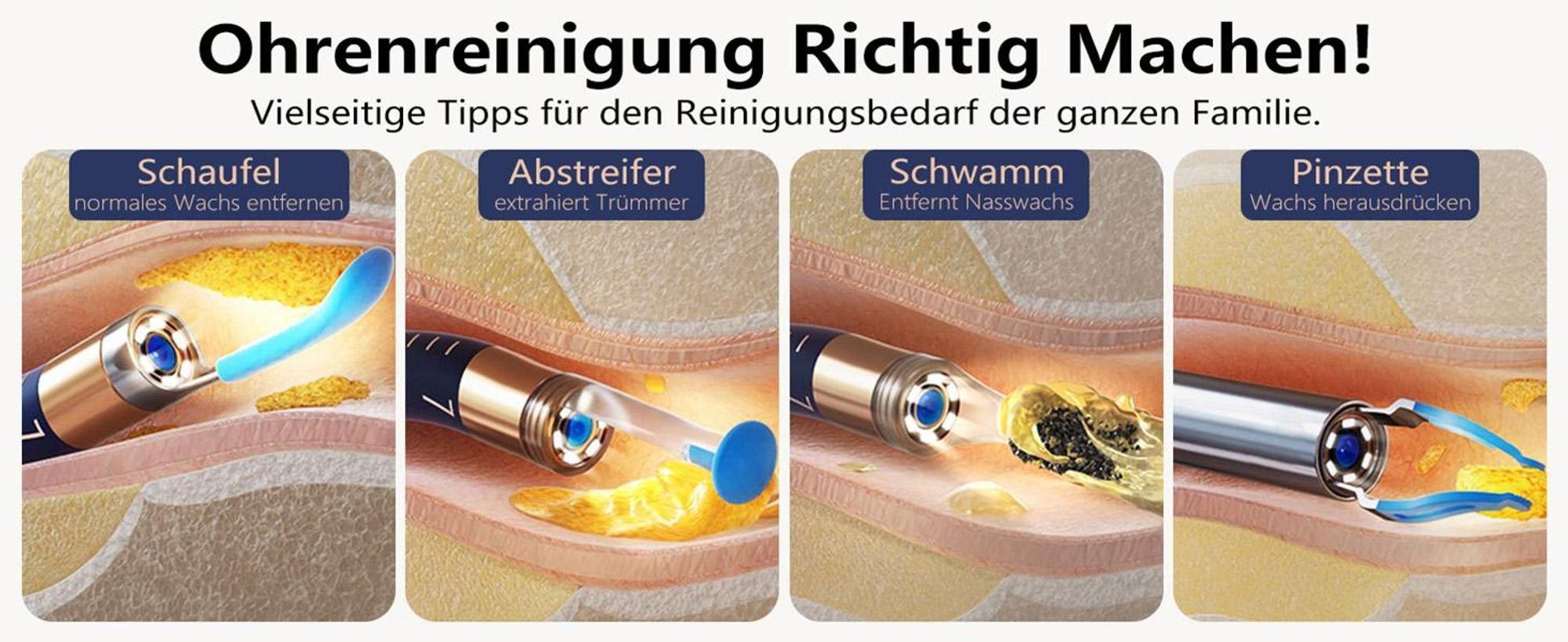 BebirdPro Ohrenschmalz Entferner Otoskop Earsight Plus, 1920P HD Einjustierbarer Ohrenreiniger mit Kamera, Otoskop mit Licht, Ohrreiniger tragbare Box