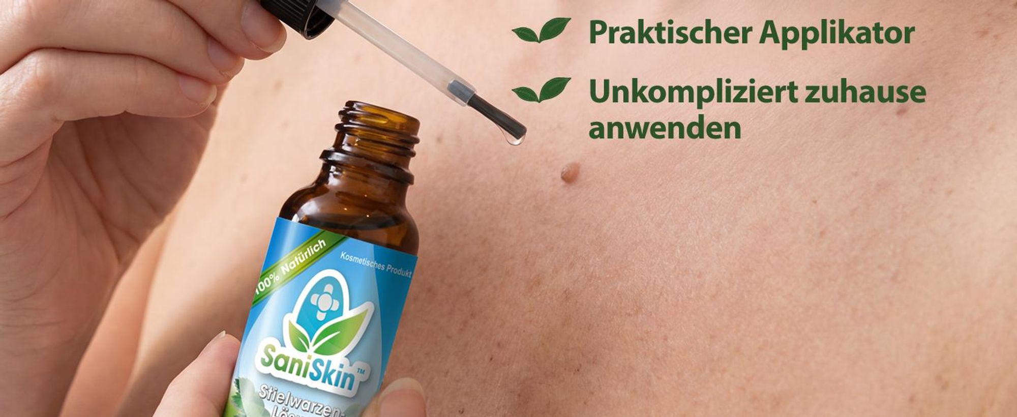 SaniSkin Stielwarzen-Lösung Set 2-tlg. Stielwarzenentferner mit Salicylsäure, Einfach & schmerzfrei Stielwarzen selbst entfernen, Für alle Hauttypen