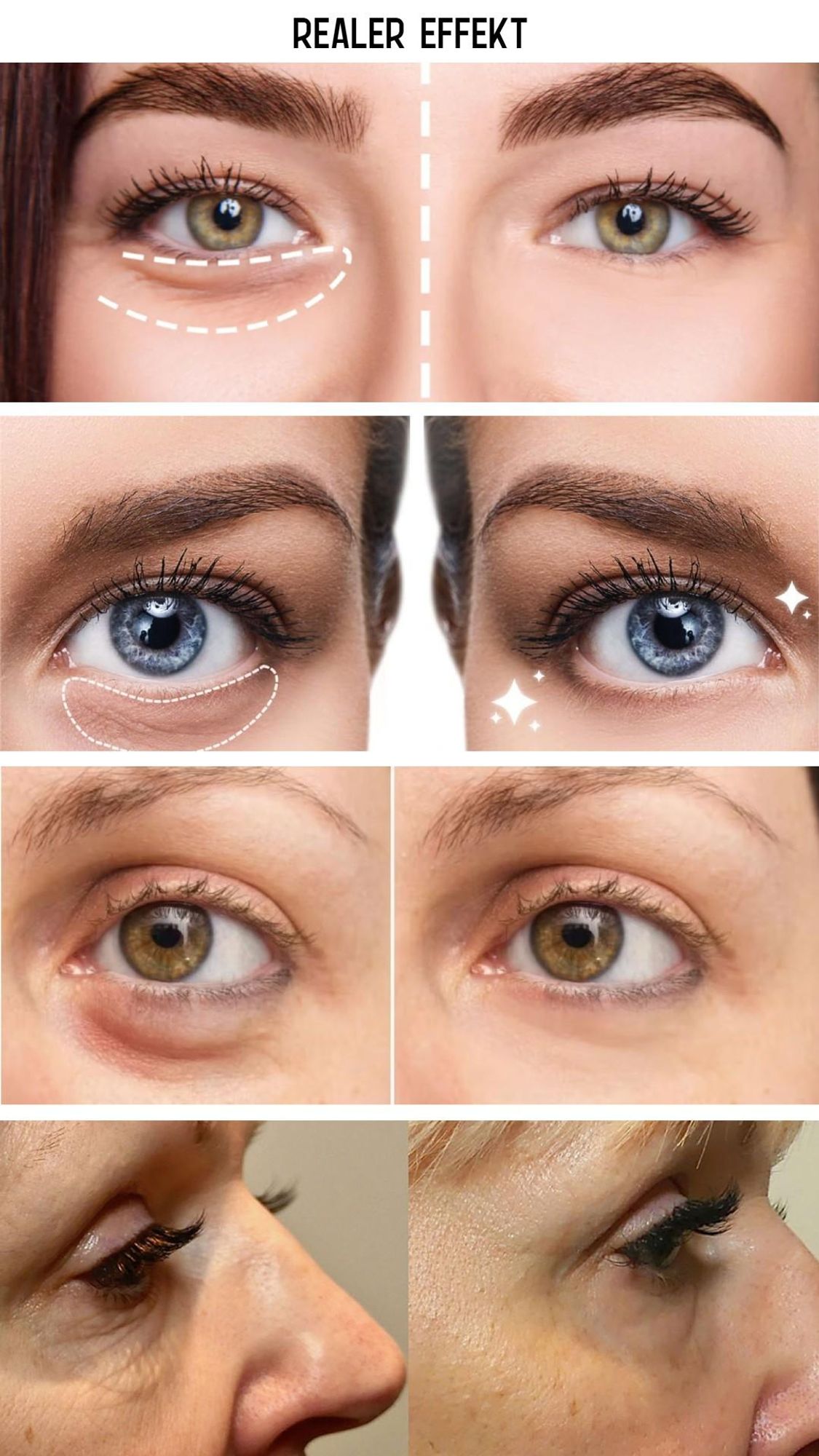 Mikrostrom brille, Straffung der Haut unter den Augen,, Gesichtslifting-Gerät 3 Intensitäts modi - GESS KUPER