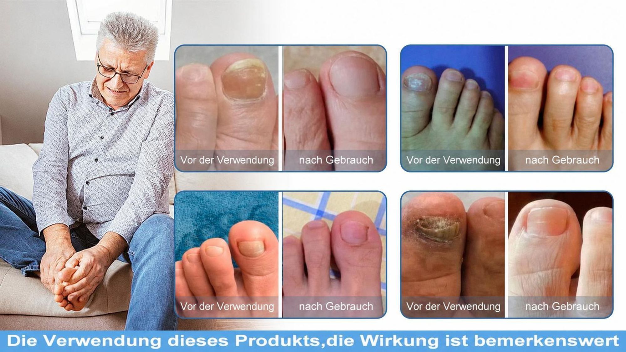 Nagelpilz Laser Gerät,22LED Aufladbar Nagelpilz Laser Behandlungsgerät,22LED 470-930mmHocheffizientes Nagelpilz Kaltlasertherapie für Finger &Fußnägel