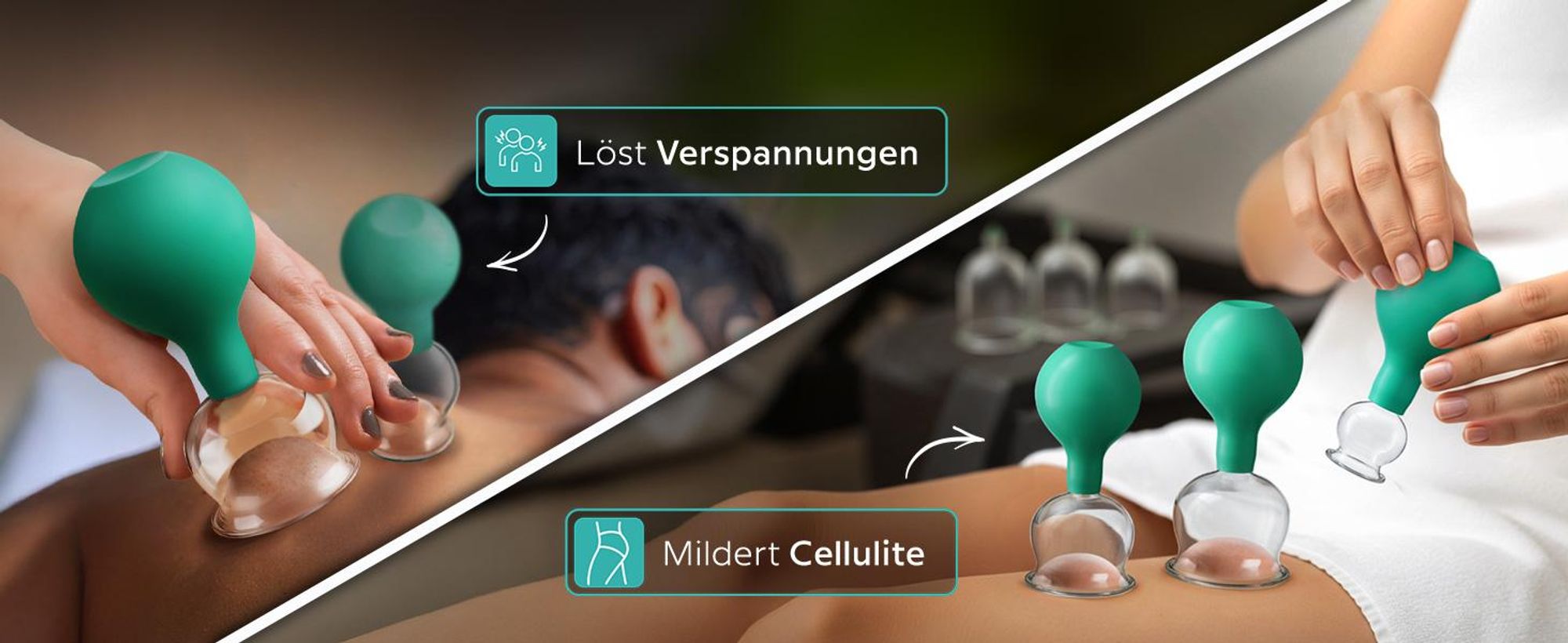 KURGLAS Schröpfgläser aus Echtglas [5 Stück] – Medizinisches Schröpfen mit Saugball & Faszienschaber – Schröpfen mit starker Saugleistung – mit e-Book