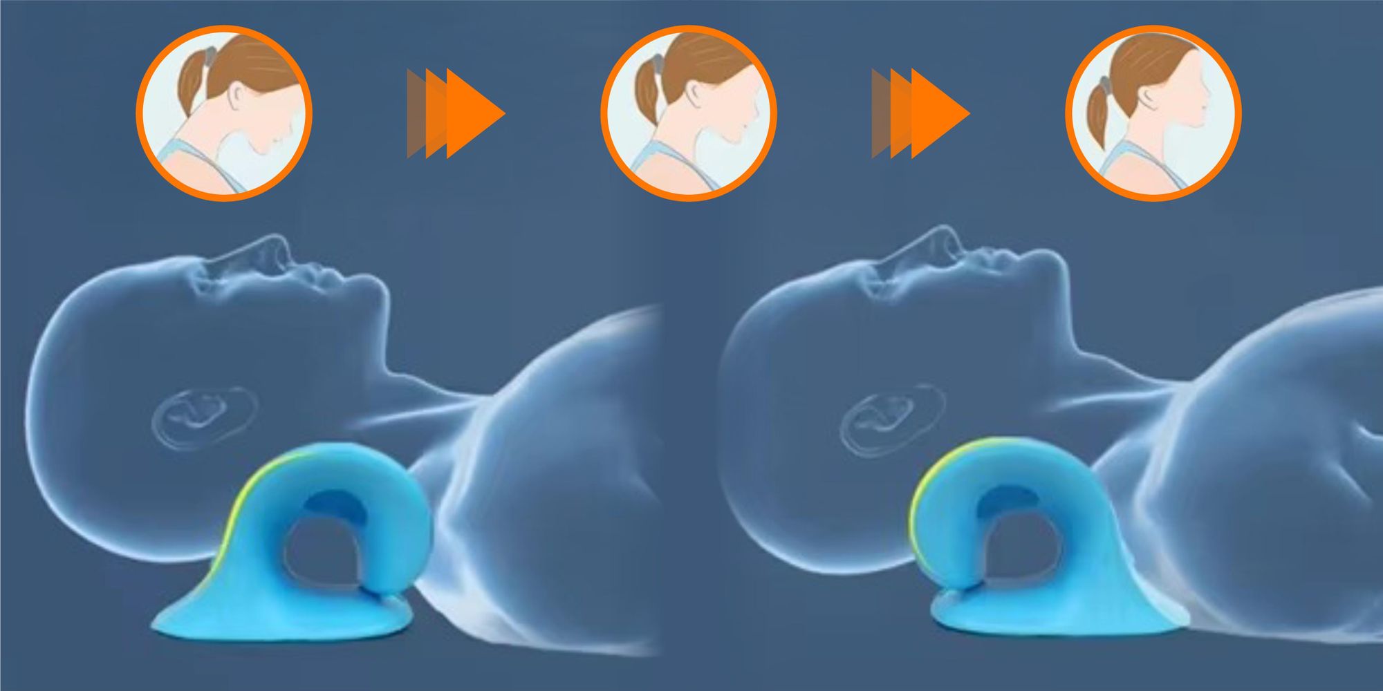 Nackenstrecker & Massagekissen zur Entspannung, Ergonomischer Nackenretter bei Schmerzen, Halswirbelsäule Korrektur mit Massagepunkten, EVI SPORT Blue