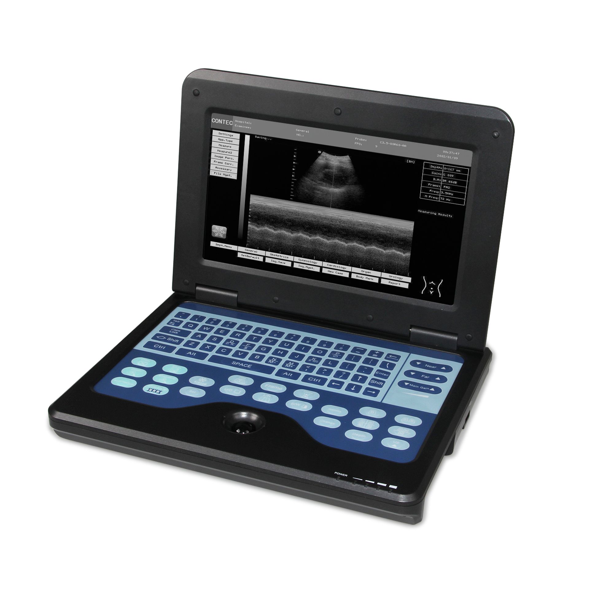 Tragbares 10,1-Zoll-LCD-Schwarzweiß-Ultraschallgerät