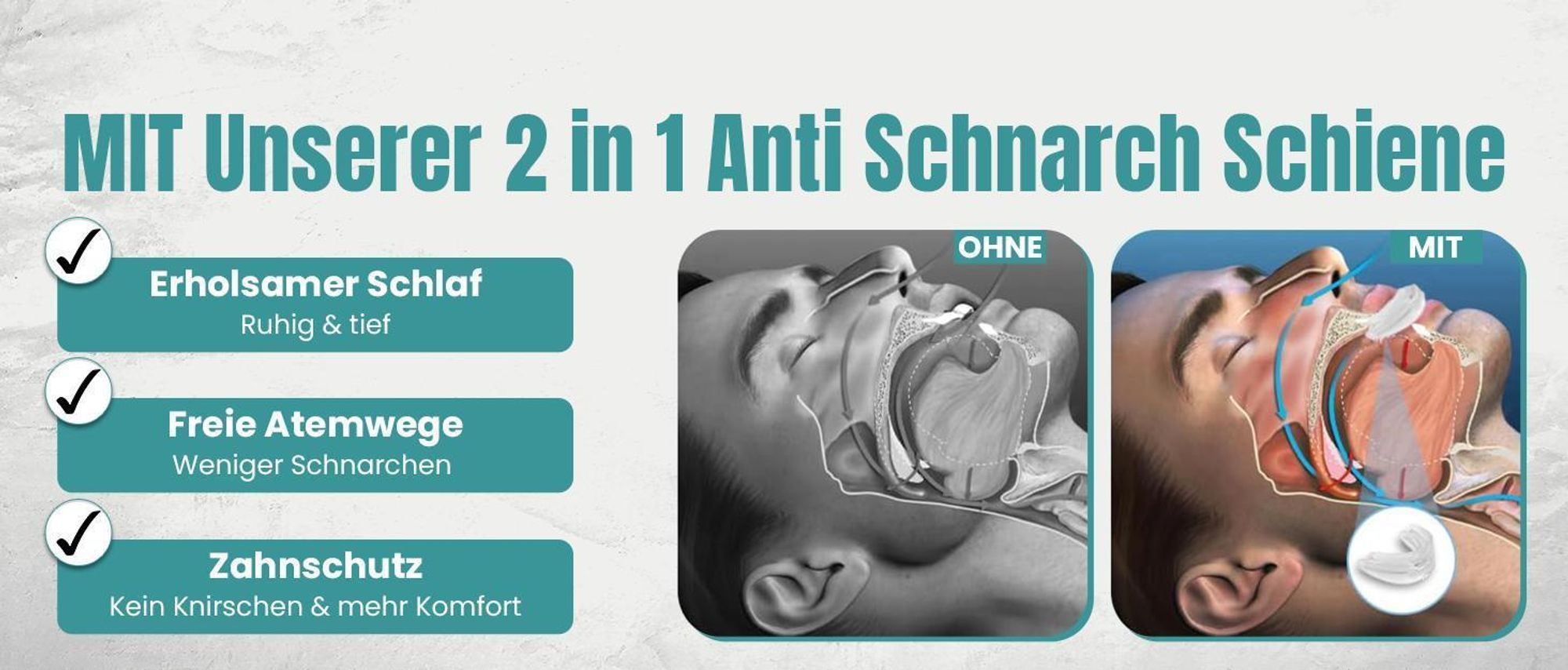 Perfekt-Schlafen24® 2-in-1 Schnarchschiene Gerät – Zahnschiene Knirschen Schnarchstopper|Schiene Knirscherschiene für Nacht| Schnarchen Stopper Zahnschutz|AufbissschieneGegen Schnarchen