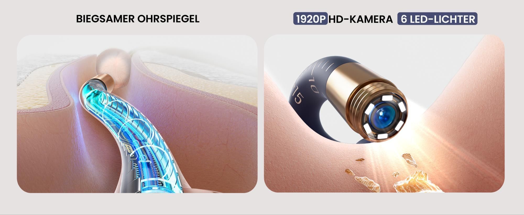 Bebird Ohrenschmalz Entferner Otoskop, 1920P HD Flexibler Ohrenreiniger Kamera, Ohrreiniger Kamera mit Pinzette, OhrKamera für Ohren/Nasen/Hals Kinder