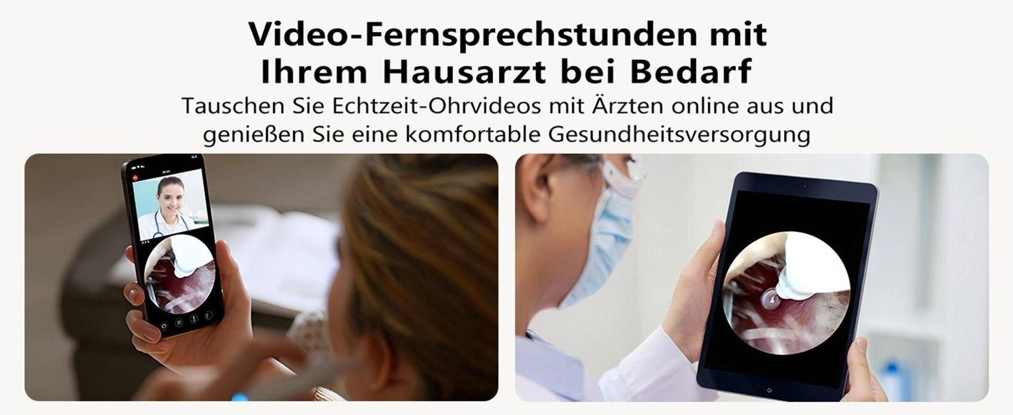 BebirdPro Ohrenschmalz Entferner Otoskop Earsight Plus, 1920P HD Einjustierbarer Ohrenreiniger mit Kamera, Otoskop mit Licht, Ohrreiniger tragbare Box