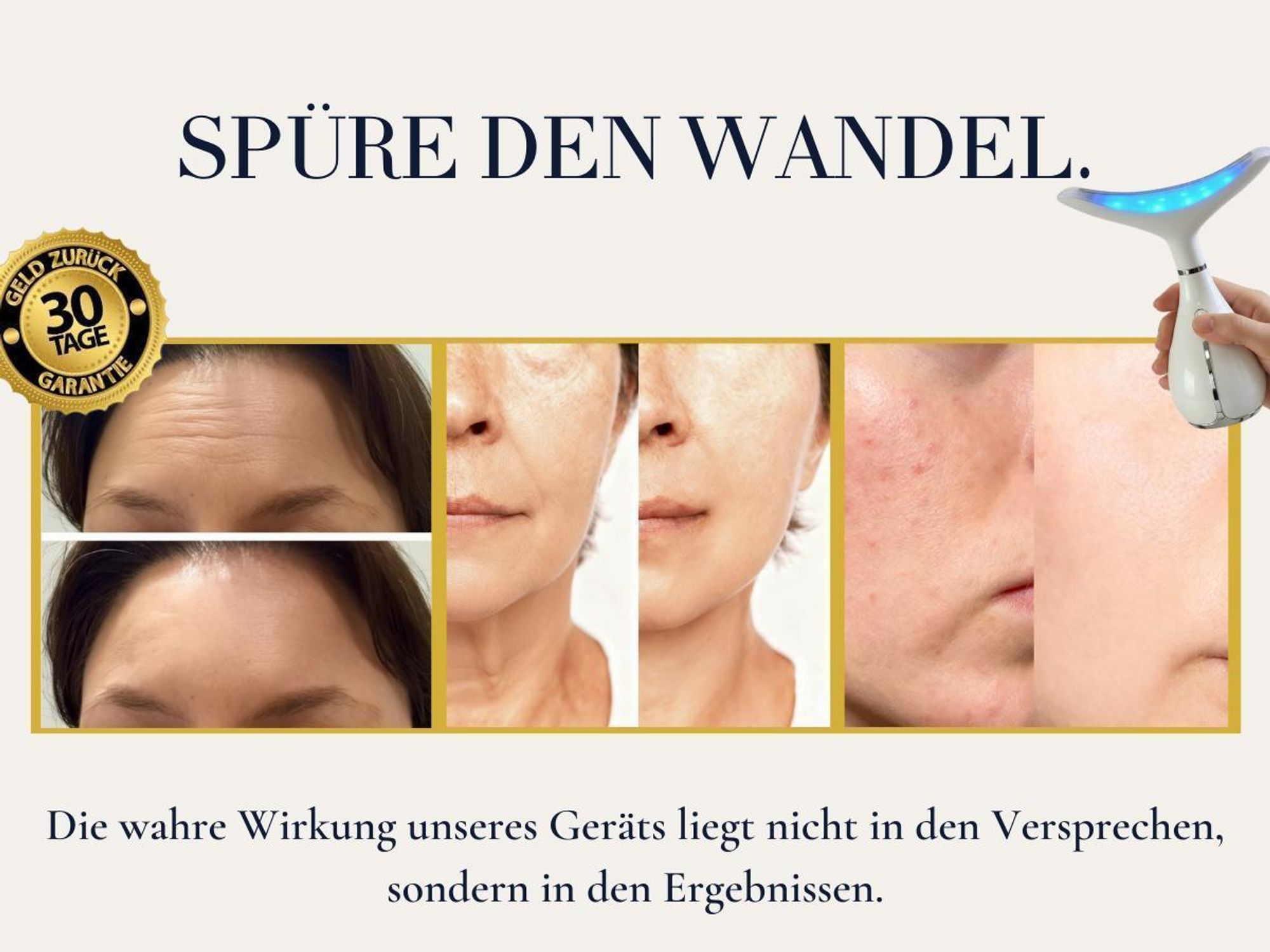 Winch Anti-Aging Miracle przeciw zmarszczkom [Nowość] - Beauty Deluxe | Odmładzanie skóry z terapią światłem TriGlow i technologią HeatCool, lifting