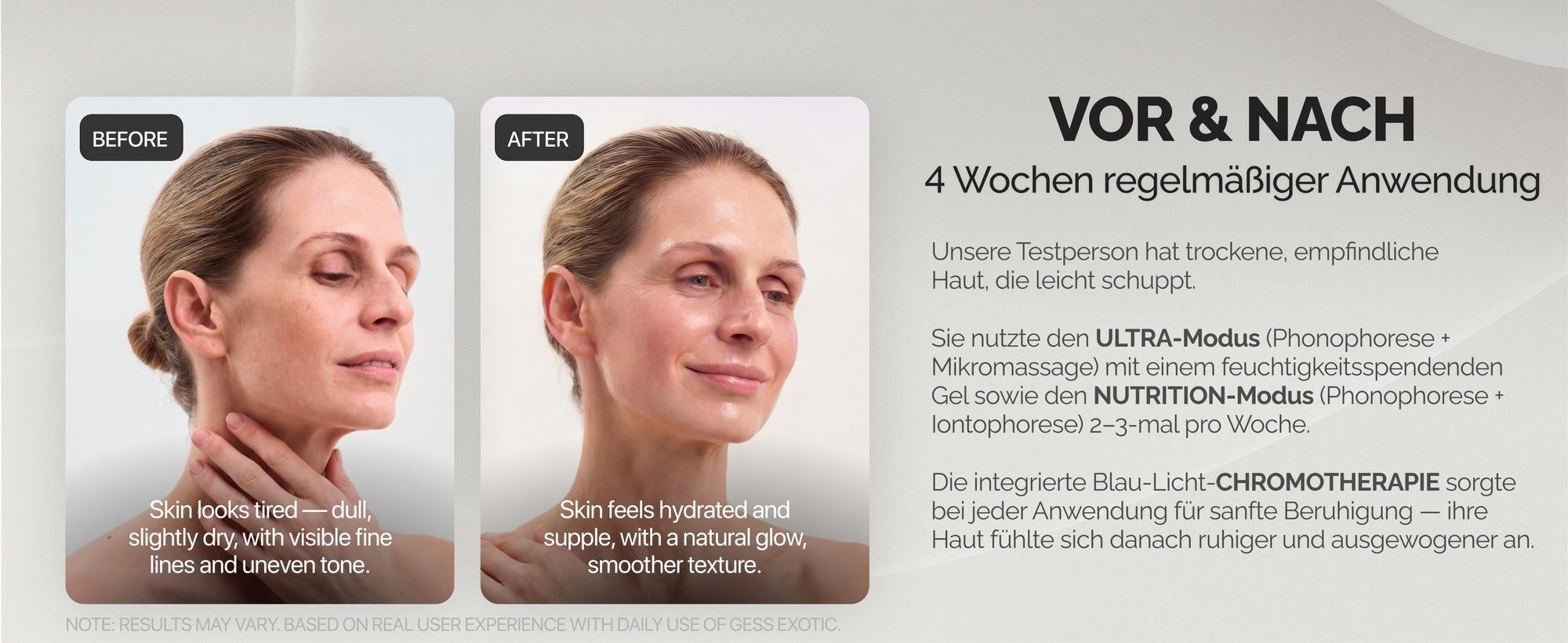 Scrubber Ultraschallpeelinggerät 7-in-1, Gesichtspeeling, Mitesserentferner - GESS EXOTIC